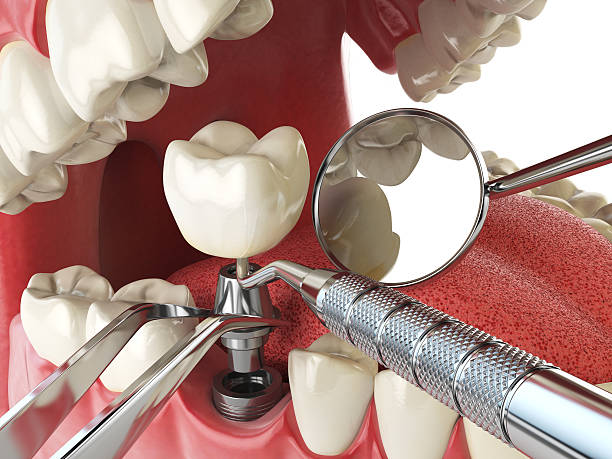 Best Mobile Emergency Dentist in USA